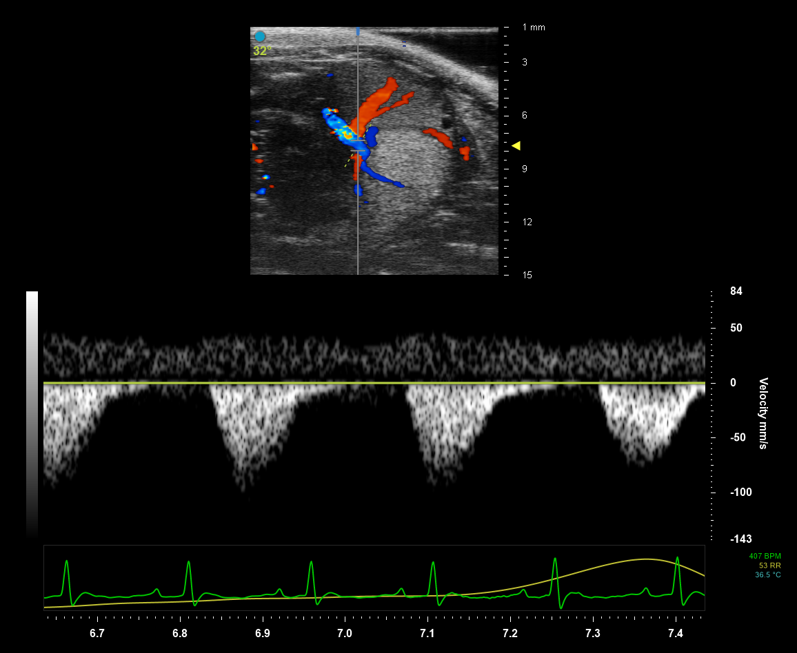 Umbilical Artery in a mouse